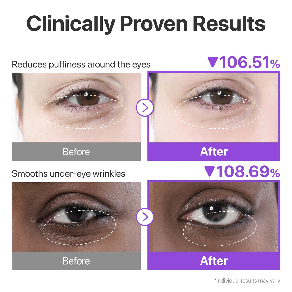 NUMBUZIN No 9 NAD+ Collagen Under Eye Patches (5 Pairs)