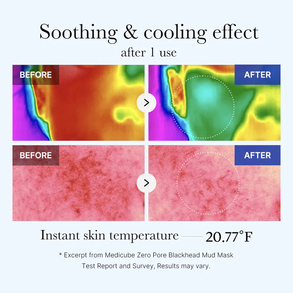 MEDICUBE Zero Pore Blackhead Mud Mask