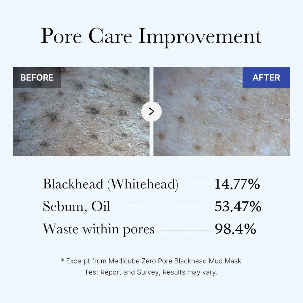 MEDICUBE Zero Pore Blackhead Mud Mask