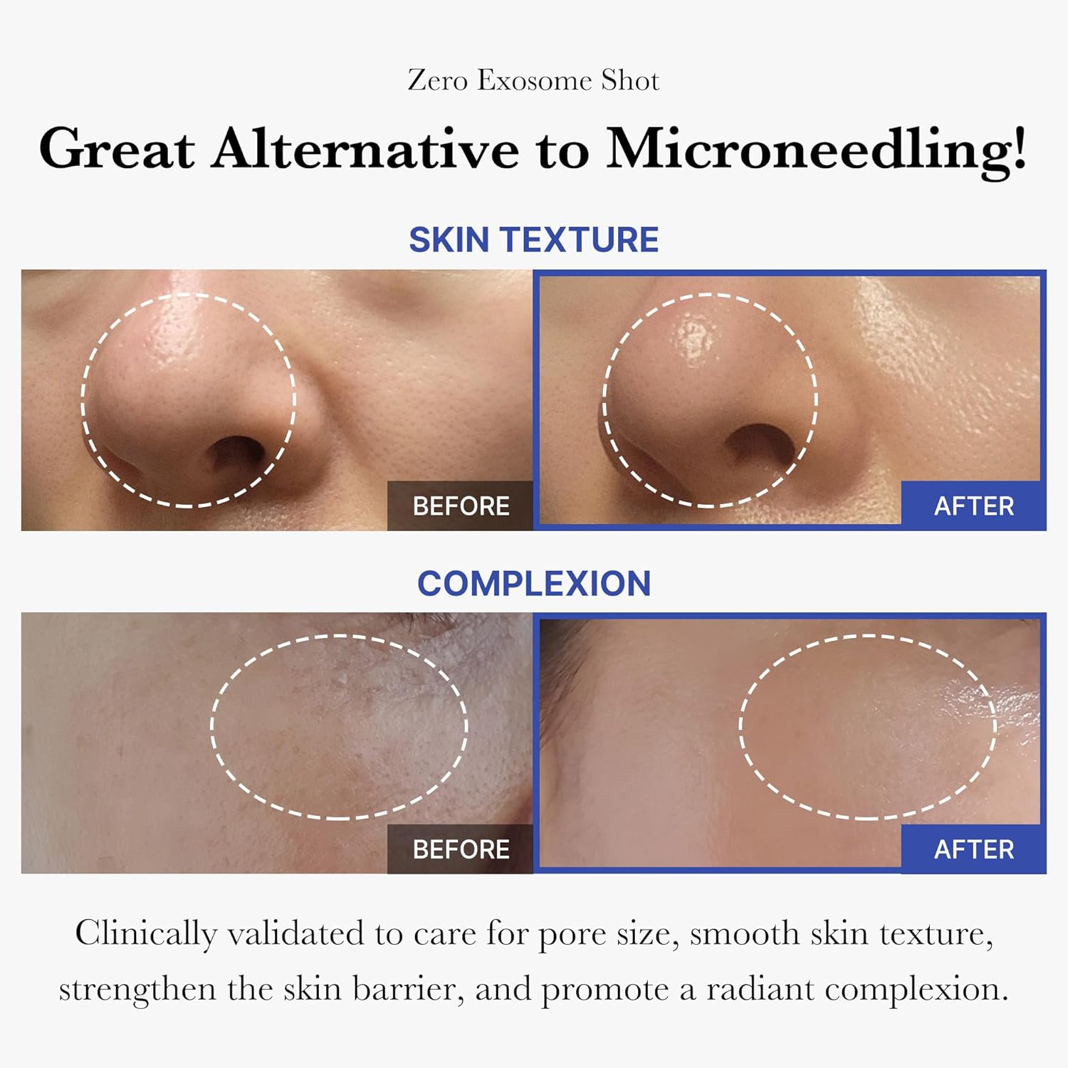 MEDICUBE Zero Exosome Shot 7500
