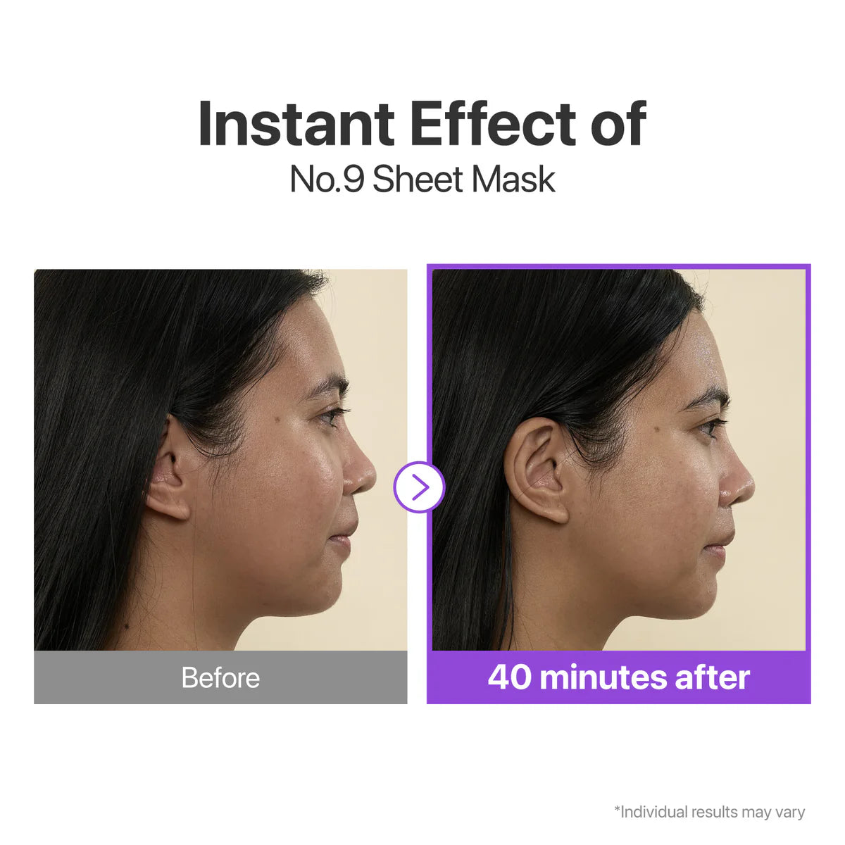 NUMBUZIN No 9 NAD+ BIO Lifting-sil Full Face Mask (4 Sheets + Lifting Band)