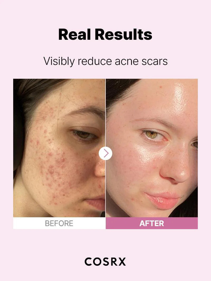 COSRX The Niacinamide 15 Serum 20 ML